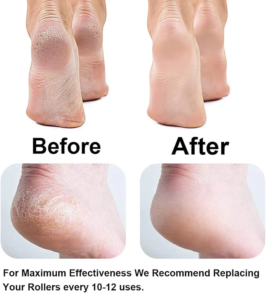 FLAWLESS pedi ELECTRONIC -  PRETTY GRIL